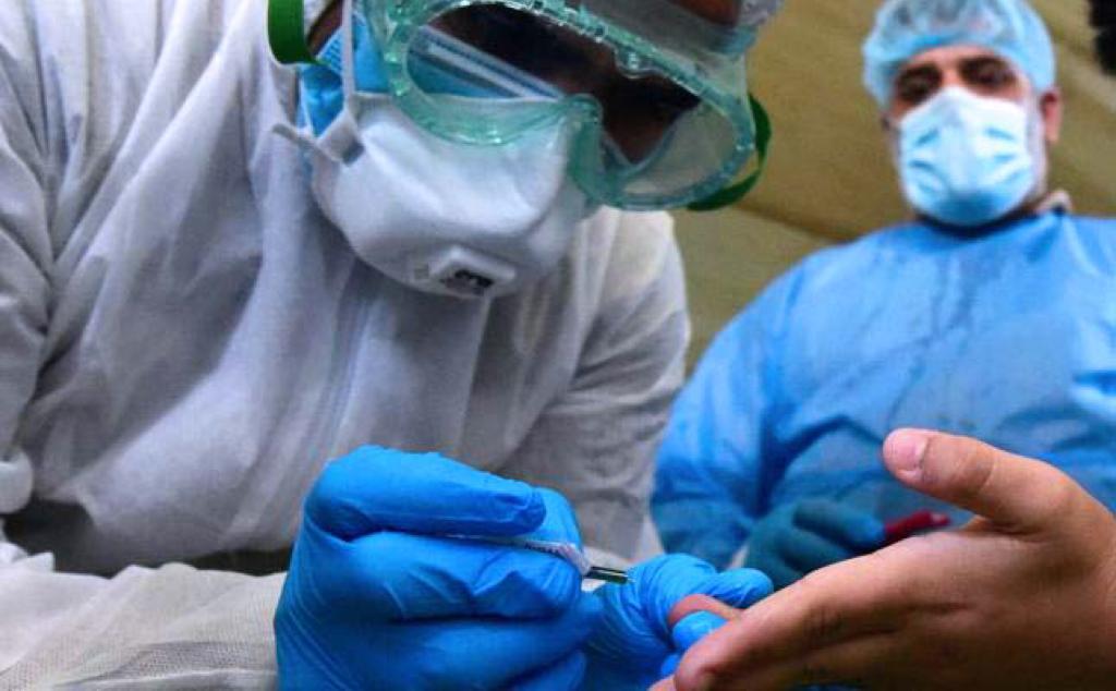2680 pacientes con TBC Y VIH fueron atendidos por EsSalud durante la pandemia