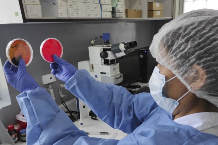 Difteria: Minsa reduce nivel de alerta epidemiológica ante ausencia de nuevos casos