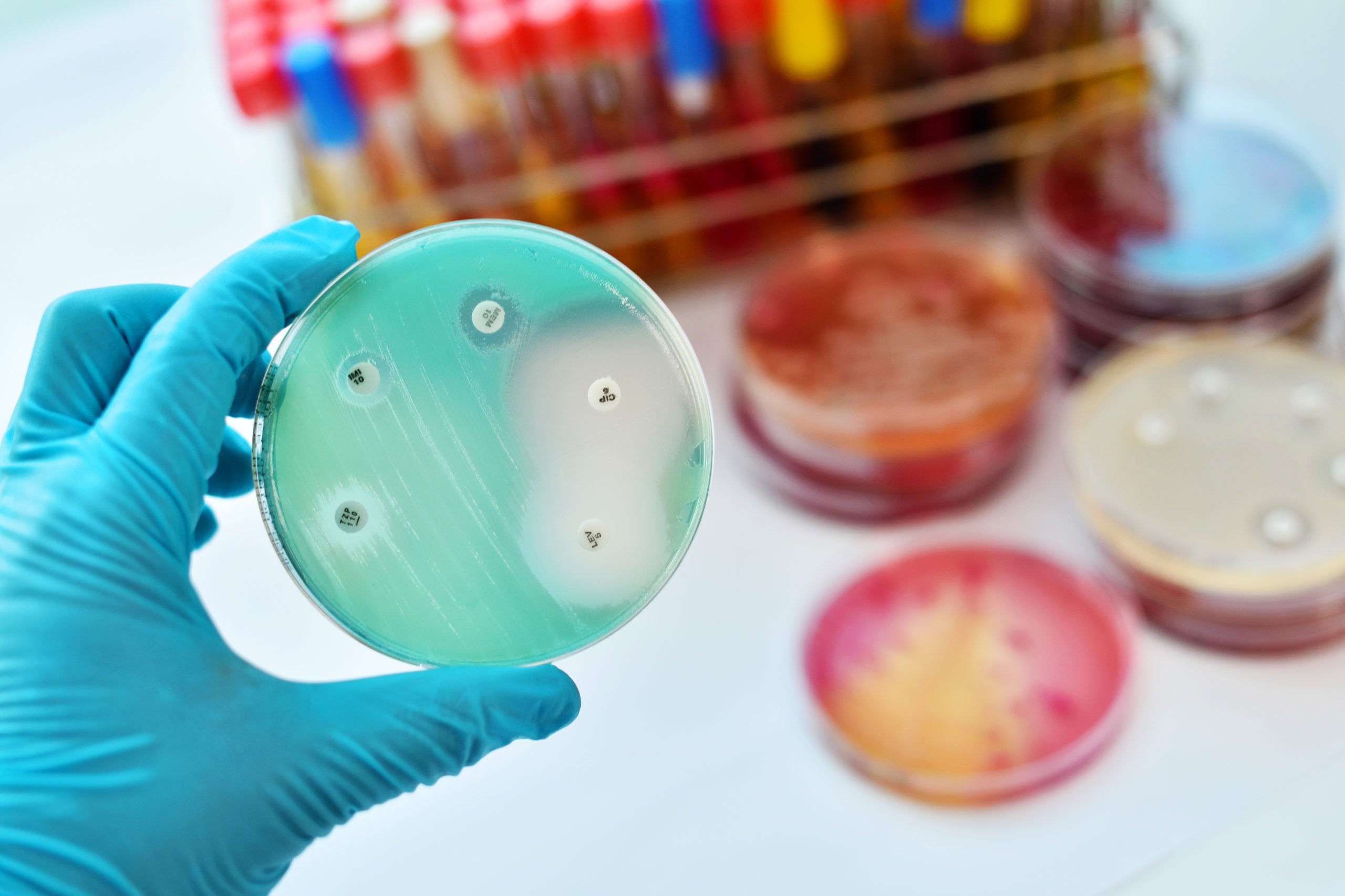 OMS realiza la Semana mundial de concienciación sobre el uso de los antimicrobianos