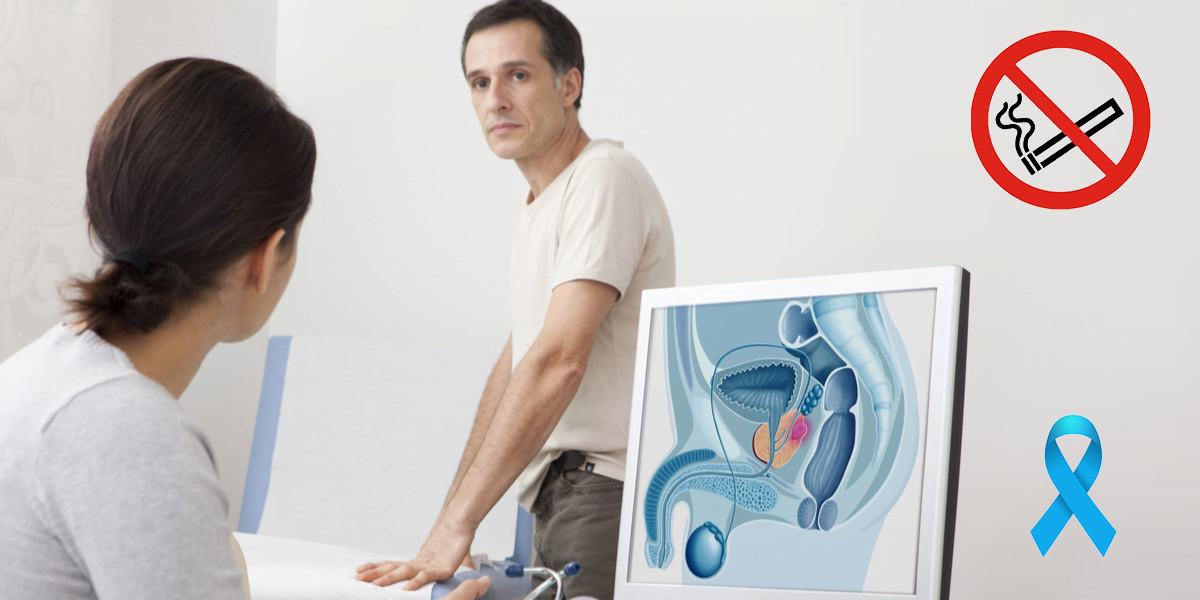 El cáncer de próstata tiene mayor riesgo de desarrollarse si fuman