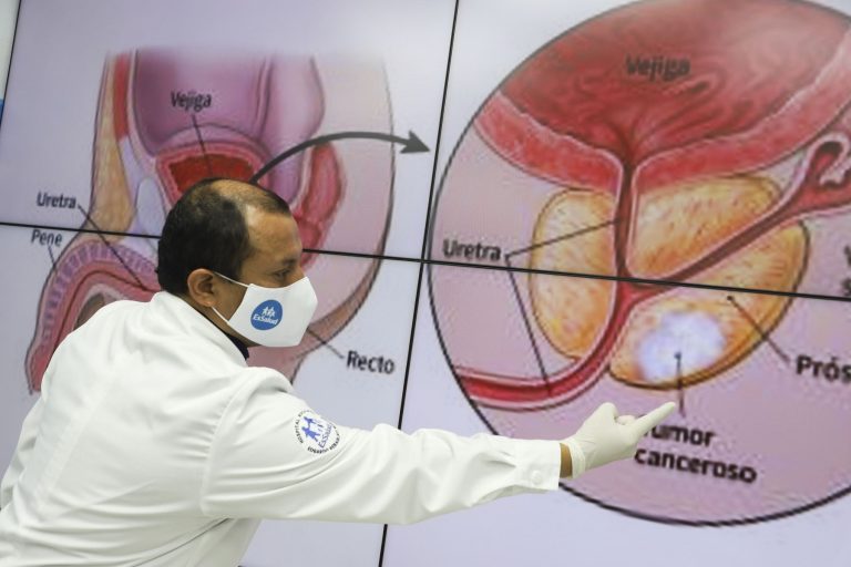 EsSalud explica la gran importancia de prevención y detección temprana del cáncer de próstata