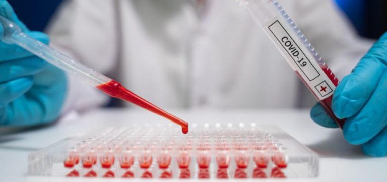 Se detecta primer caso de variente india de la COVID-19 en Perú