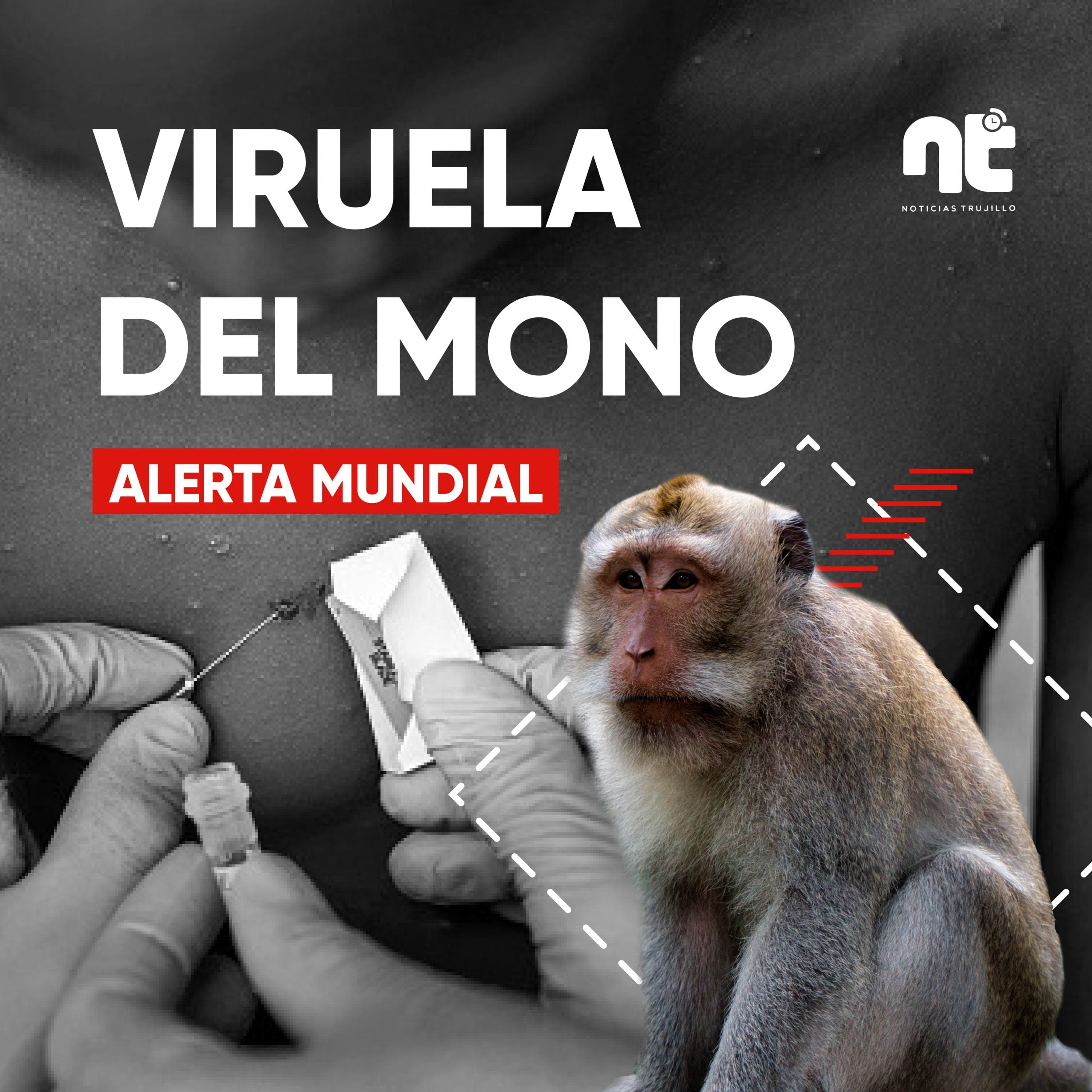 Bolivia reporta su primer caso sospechoso de viruela del mono