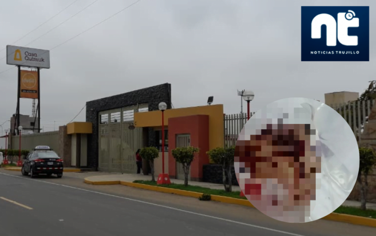 Niña es desfigurada tras ataque de perros en Moche