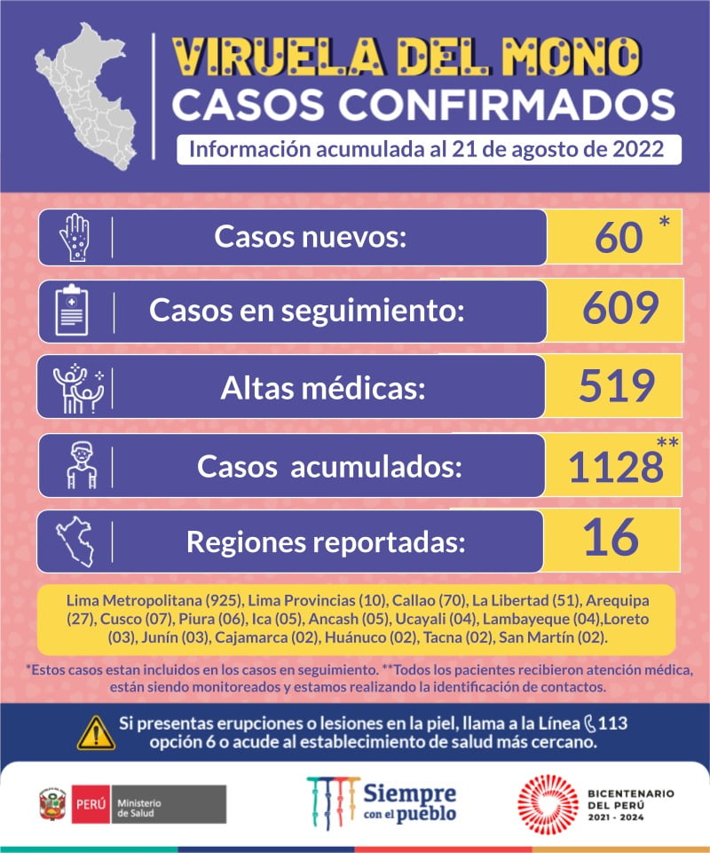 Viruela del mono: Se elevan a 1128 los casos confirmados de esta enfermedad en el Perú