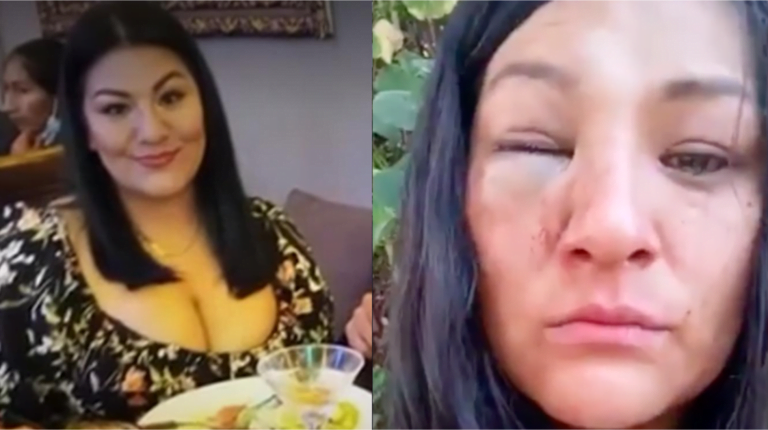 Cantante folclórica sobre agresión: “La Policía no me atendió porque era feriado”