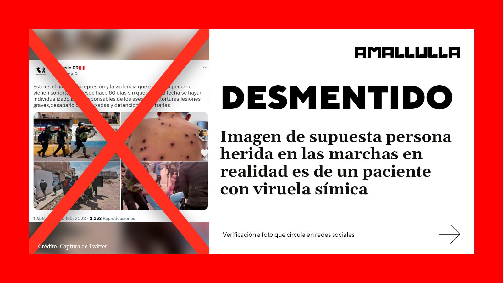 <strong>Desmentido: imagen de supuesta persona herida en las marchas en realidad es de un paciente con viruela símica</strong>