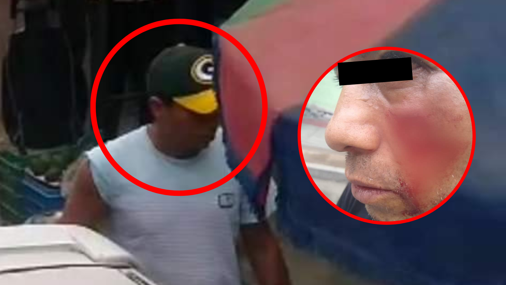 Trujillo: vendedor de pescado corta el rostro a trabajador del Segat