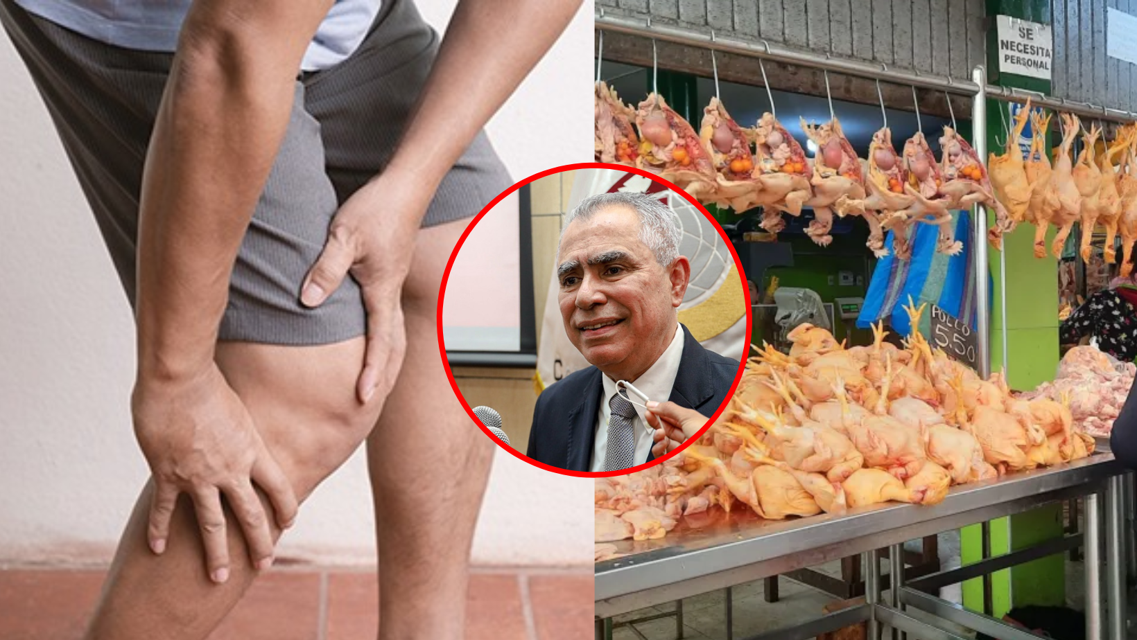 Cámara de Comercio descarta contagio del Síndrome de Guillain Barre por consumo de aves