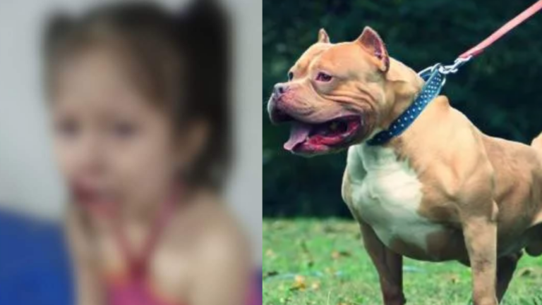 Trujillo: Niña es atacada en el rostro por perro de raza pitbull en Alto Trujillo