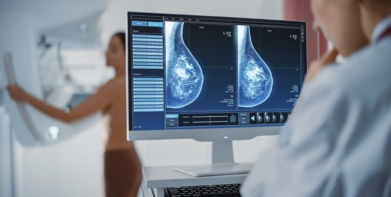 Trujillo: mamografía y resonancia como herramientas vitales en la lucha contra el cáncer de mama