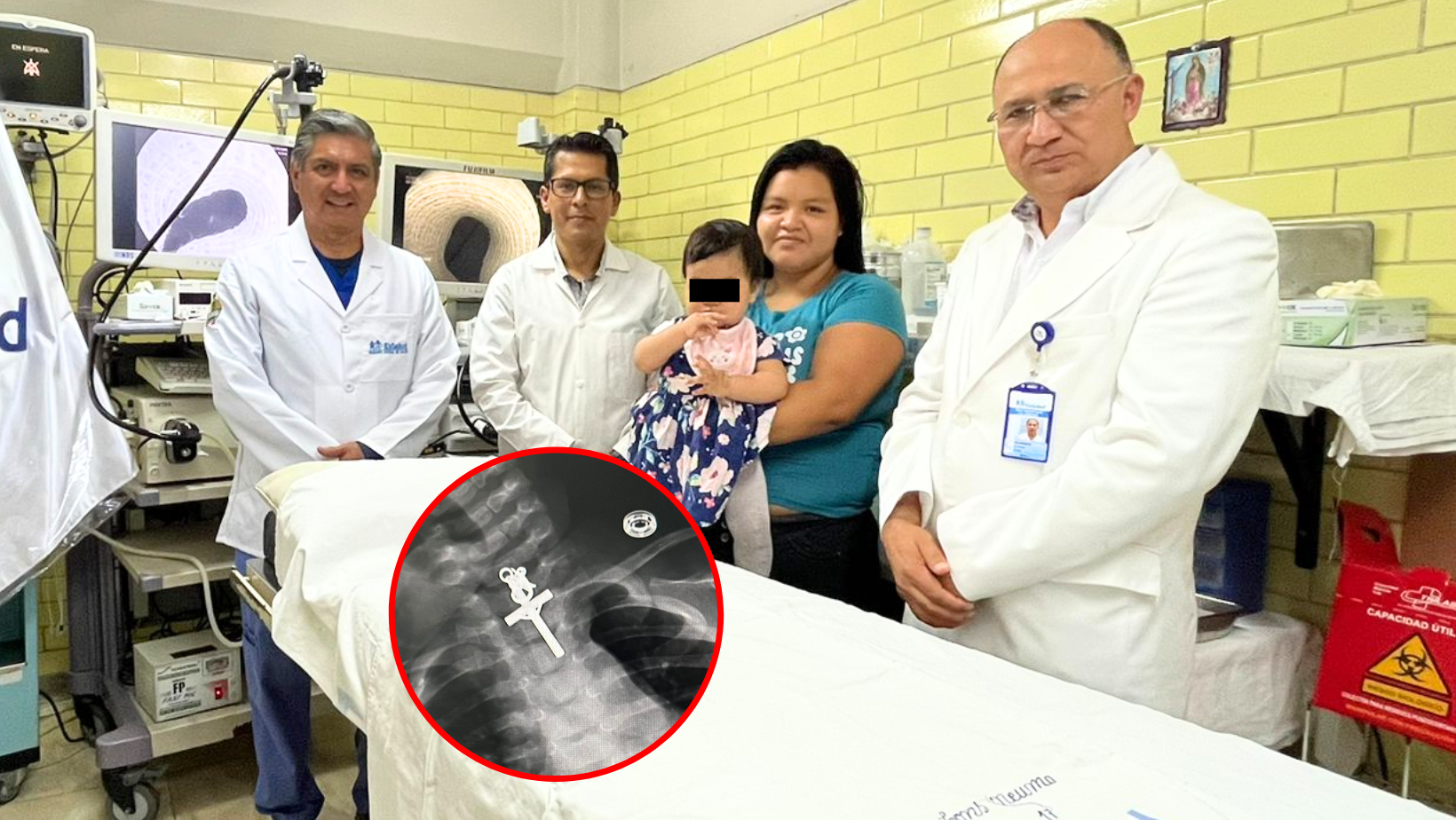Trujillo: Médicos del hospital Lazarte salvan la vida de una bebé  de 10 meses al extraer un crucifijo en su esófago