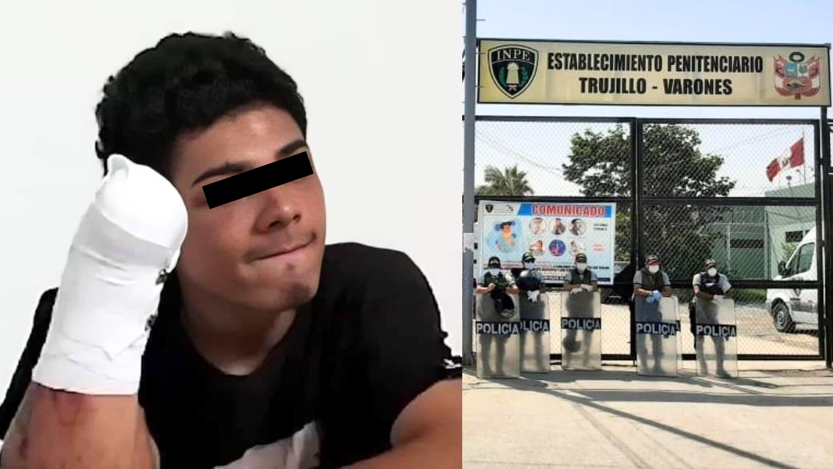 Trujillo: Dictan 9 meses de prisión preventiva para extorsionador que perdió la mano tras detonar explosivo