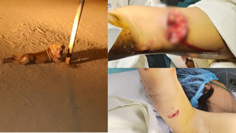 Florencia de Mora: Niña queda gravemente herida tras el feroz ataque de un pitbull