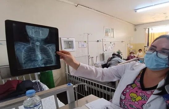 Niña traga moneda de un sol y es operada de emergencia en su primer día de clases