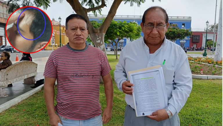 Trujillo: acusan a policía por agresión e intento de asesinato a joven