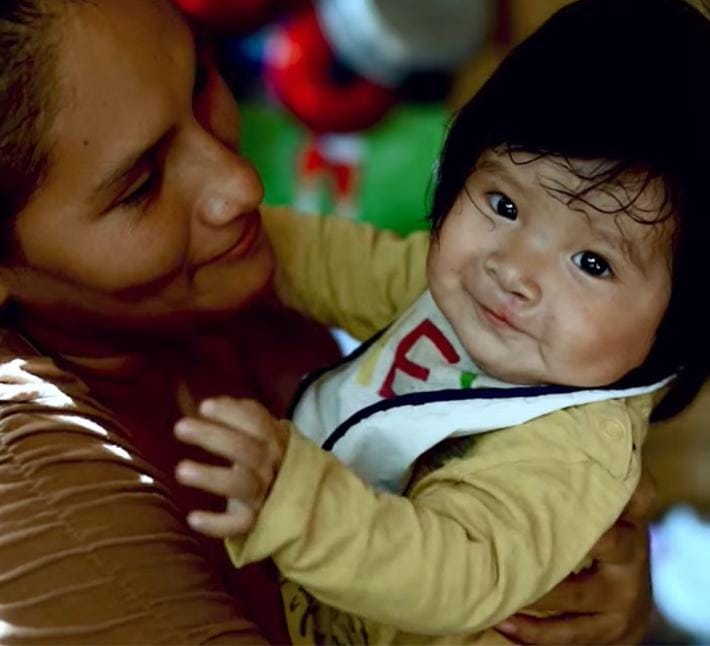 Fundación Alvartez y Grupo San Pablo realizarán cirugías gratuitas a niños con labio leporino y paladar hendido en Trujillo