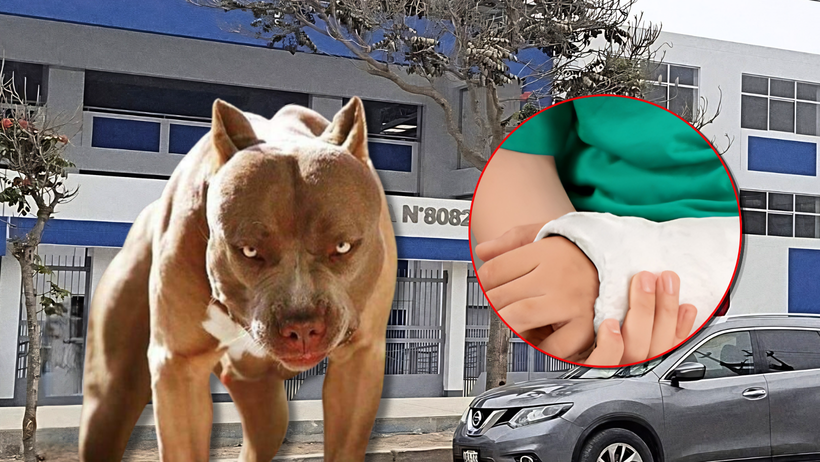 Escolar atacada por perro en La Esperanza necesita injerto de piel