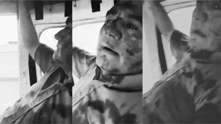 ¡Extorsiones imparables! Chofer baleado y desangrándose fue llevado al hospital en mototaxi